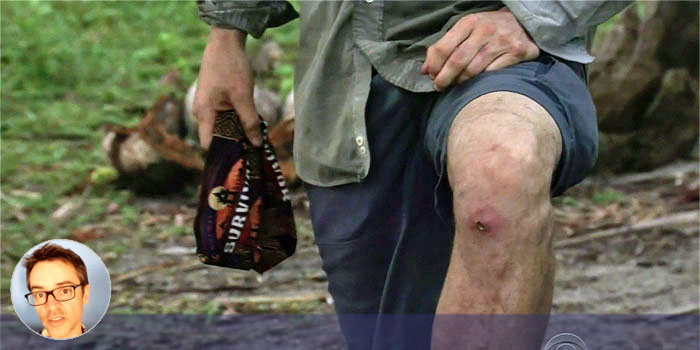 Ep7: Battle of the bulges